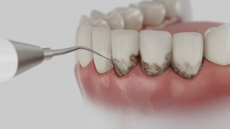 Trusted Tooth Extraction service in Cutler, CA - Dentist Open Now